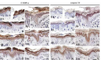 Figure 5. The expression of C/EBP- and caspase-14 in the and uted in the suprabasal layer (A) and granular layer (H), respectively