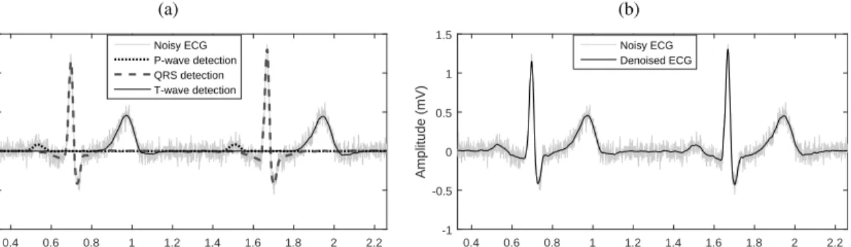 Fig. 4. Panel (a): Noisy ECG beats (SNR = 10 dB) with QRS and T-waves components overlaid, as extracted by means of EKS6