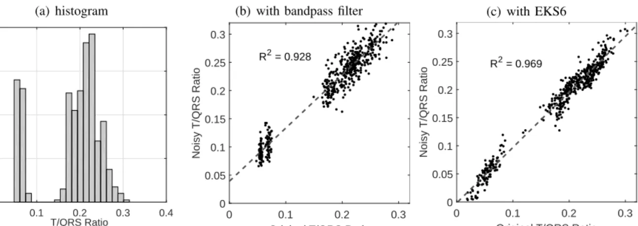 Fig. 5. Panel (a): histogram of T/QRS ratio values for ECG signals from the PhysioNet PTB Diagnostic ECG Database