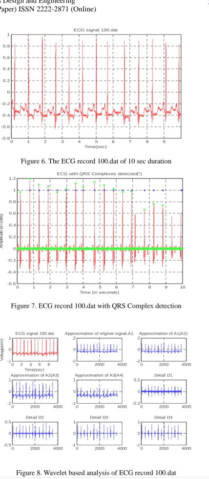 Figure 6. The ECG record 100.dat of 10 sec duration 
