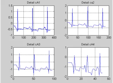 Figure 10. Details cD1 to cD4                   