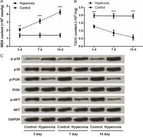 Figure 4. Expression levels of SP-B and TGF-β1 in lung tissues after newborn rats exposed to hyperoxia for 3, 7, and 14 days