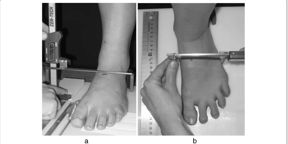 Fig. 1 Procedure for the measurement of midfoot height (a) and midfoot width (b) to calculate foot mobility magnitude