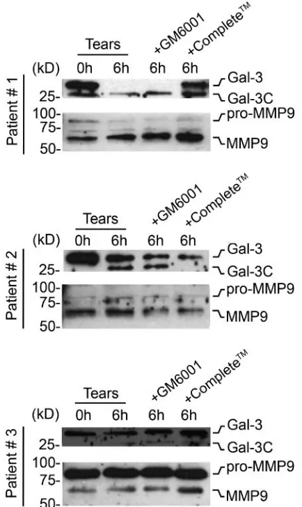 Figure 5. Degradation of galectin-3 in human tears involves protease activity. Immunoblots 