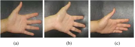 Figure 1. NIR image of palm vein and feature point mark. (a) NIR image of palm vein; (b) bifurcation point and 
