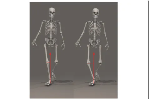 Figure 2 Frontal plane external KAMs: 1st peak KAM, 2nd peak KAM and knee adduction angular impulse (KAAI), which represents thearea under the curve.