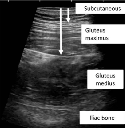Figure 1. Example of ultrasonographic image. 