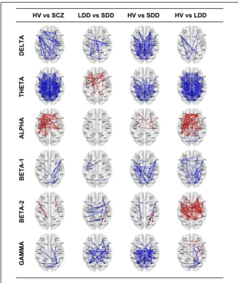 FIGURE 1 | Resting-state EEG SFC results of the four comparisons in