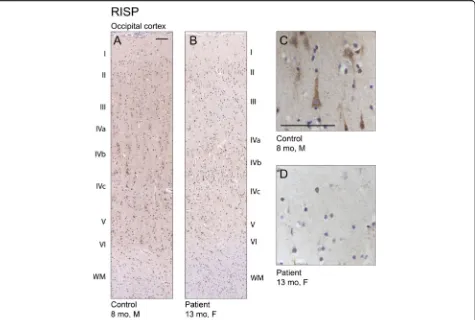 Fig. 4 Reduced Rieske iron-sulfur protein (RISP) immunoreactivity in patient brain. a Immunostaining for RISP in the occipital cortex of controland (b) patient brain