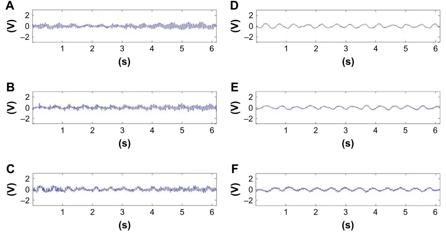 Figure 4 Power spectrum distribution in all signals recorded from the C0 level for particular age groups.