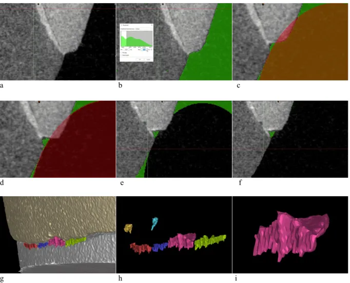 Figure 4: Insight into segmentation and measurements 