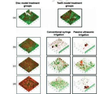 Figure 5 Comparisonofthebioﬁlmdisruptingefﬁcacybetween disc model bioﬁlm and tooth model bioﬁlm usingchlorhexidine, trypsin and proteinase K with conventionalsyringe irrigation.