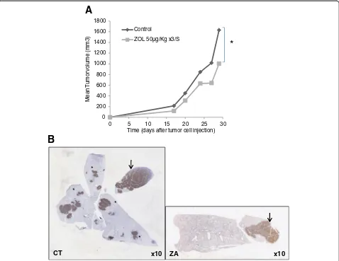 Figure 3 Effect of ZA on tumor progression and metastasis dissemination. Acan be seen in control mice whereas only a big one (arrow) is seen in ZA treated mice