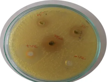Fig  5:  showing  varying  measurement  of  zone  of  inhibition  of  Streptococcus  mutans  around  different 