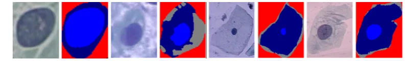 Figure 5. Sample cervical smear images and manual segmentation (ground truth) images [15-17] 