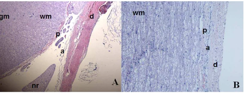 FIGURE 1. Haematoxylin and Eosin stained porcine meninges. (A) Transverse view of the 3 meninges