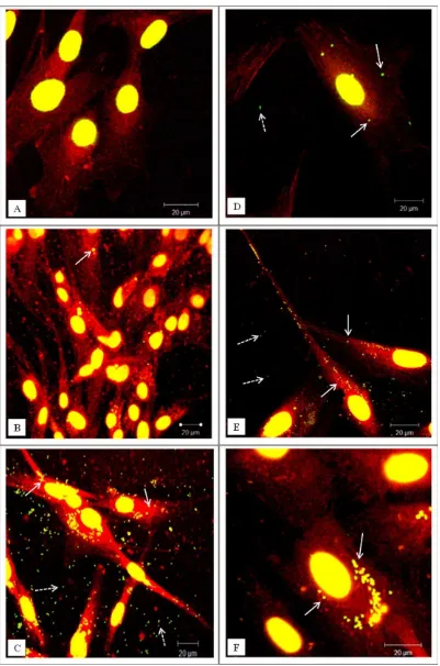 FIGURE 3. Representative confocal microscopy images of cells exposed to green ﬂuorescent microspheres (1epithelial cells
