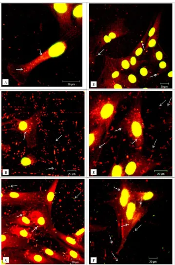 FIGURE 5. Representative confocal microscopy images of cells exposed to green ﬂuorescent nano-particles (40 nm in diameter)