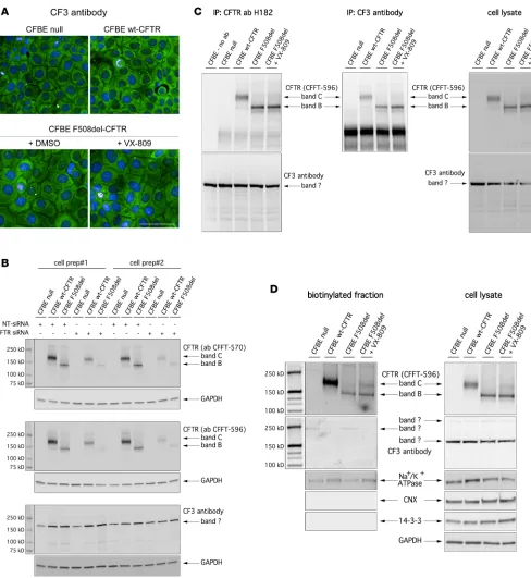 Figure 5. Validation of CF3 antibody. (cells following 24-hour treatment with DMSO alone (0.1%) or VX-809 (3 A) Confocal microscopy images showing immunolocalization of WT-CFTR or F508del-CFTR protein in CFBE41o- μM), as detected by the CF3 antibody