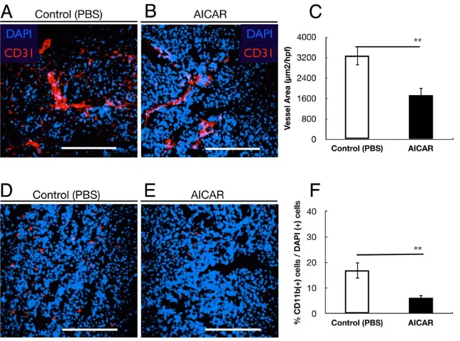 Figure 3. AICAR suppressed tumor angiogenesis and inflammatory cells infiltration. (A, B) Microvessel density in tumor tissues was(red) in Y79 xenografts