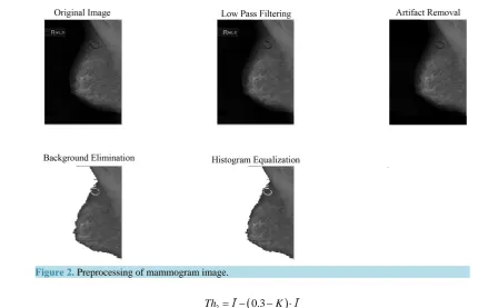 Figure 2. Preprocessing of mammogram image.                                                                               
