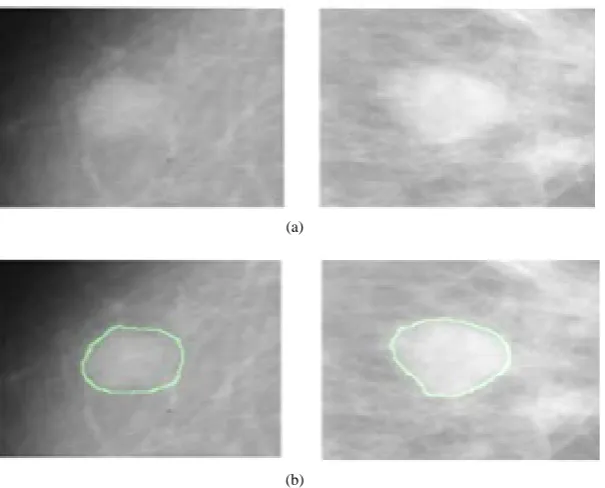 Table 1.  Summary of Computed mammogram image features.                                                                               