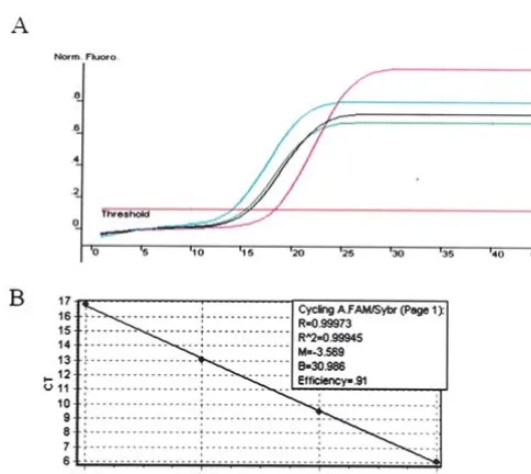 Figure 4. Overexpression of Aurora-A in esophageal cancer cell lines.Reverse transcription PCR showed increased Aurora-A mRNA level in 6 outof 7 esophageal squamous cell carcinomas (upper panel)