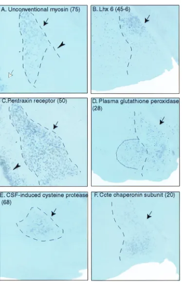Fig. 3.Expression of amygdala-enriched genes in different amygdaloidsubunit, TIGR identiﬁer TC30886)