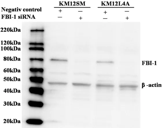 Figure 5. Suppression of FBI-1 could repress proliferation of colon cancer cells (A. KM12SM cell line; B