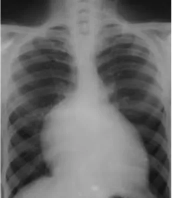 Figure 1. ECG findings