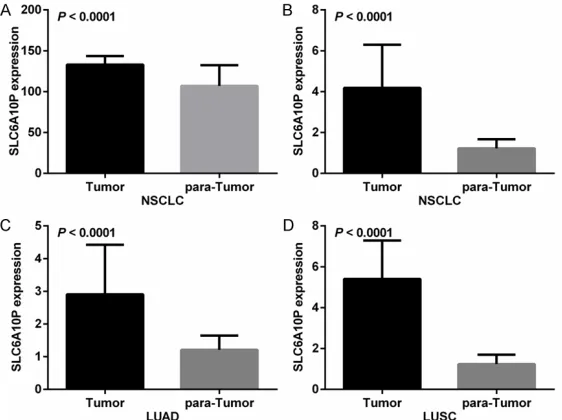 Figure 1. In situ hybridization analysis of 140 lung cancer patients. A. Nega-tive SLC6A10P staining in normal lung tissues
