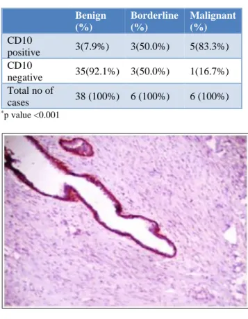 Table 1: Relationship between patients age and           tumor grade. 
