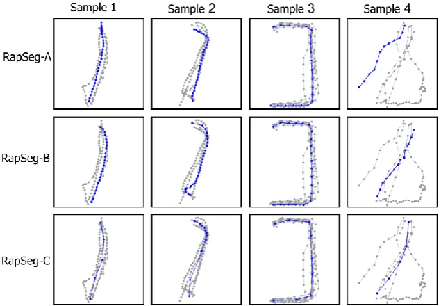 Figure 9. Examples of divide-and-conquer (RapSeg-C) approach for handling the curvy model
