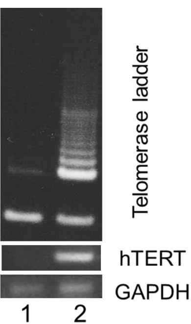 Figure 7. Telomerase activity assay. Lane 1, The bi-opsy specimen. Lane 2, Negative control without template
