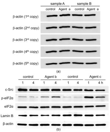 Figure 7. Detection of protein levels in 5 membranes from a single gel using two cancer cell lines