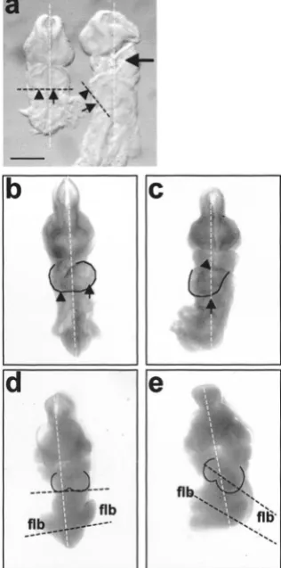 Figure 4. Abnormal heart looping in(arrowhead) ventricle positioned to the left and right sides of themidline, respectively