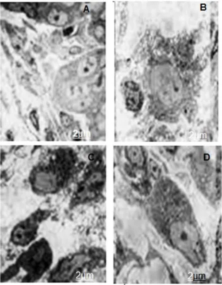 Figure 3. (A) Surface morphology of SUDHL-4 cells treated with 100 μg/mL chitosan nanoparticles for control cells; (B) 30 min; (C) 2 h; and (D) 4 h