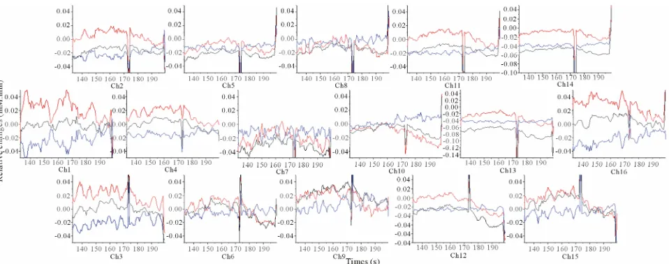 Figure 3. Grand average (16 subjects) concentration changes of oxyHb, deoxyHb and totalHb during 5% sweetened solution  