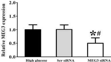 Figure 1. Expression pattern of MEG3 in HUVECs upon high glucose stress. HUVECs were cultured in the medium containing 5 mM D-glucose (control), 30 mM D-glucose (high glucose)
