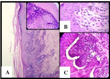 Table 2: Histological features. 