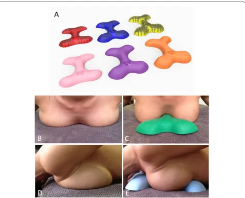 Figure 1 Orthosis in different sizes and densities, the transparent models illustrate the orthosis’ ribbing for adjustment offirmness (A); Participant positioning on the orthosis in cephalic view (B), side view (C), lateral view without the orthosis (D) andwith the orthosis (E).