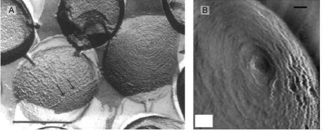 Fig. 3. Freeze etch SEM (A) and AFM (B)images of the surface of intactScale bars: (A) 500 nm; arrows indicate thickboundary line, (B) 50 nm (Amako S