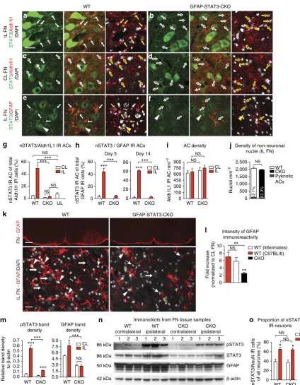 Figure 1 | STAT3 activation is necessary for reactive transformation of perineuronal ACs after remote injury