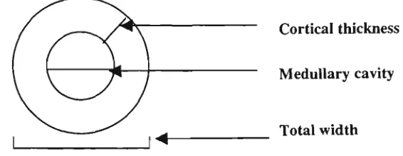 Figure 2.1: The dimensions of bone 