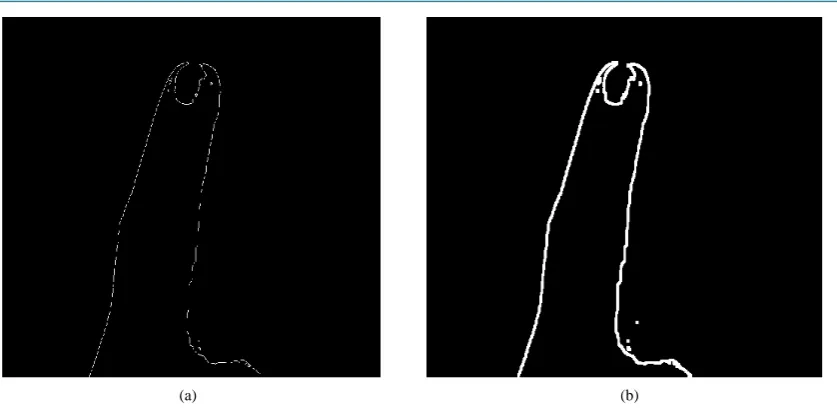 Figure 3. The results attained with (a) Edge Detection and (b) Edge Enhancement Schemes