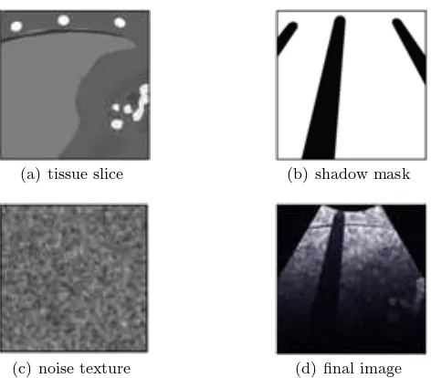 Fig. 4 Ultrasound image composition.
