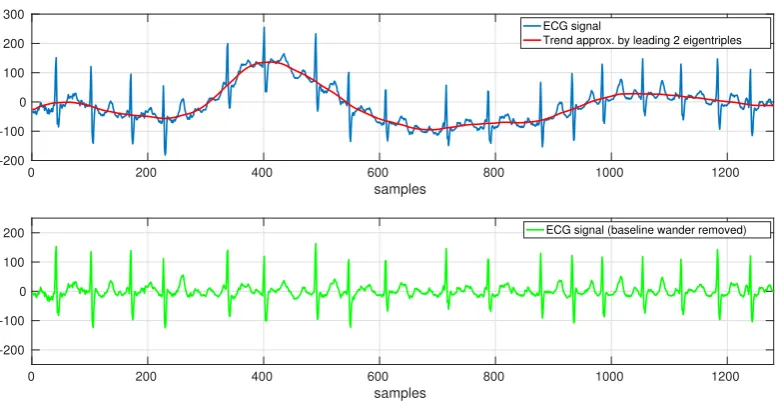 Figure 1. Application example of basic SSA: baseline wander removal. Showing excerpt 02:20 - 02:30 fromrecord 14149m MIT-BIH ltdb [46]