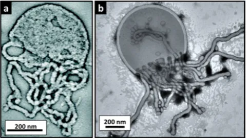 Figure 10. Transmission electron micrographs obtained for (a) apermission from ref 42) and (b) a similar species observed during thepost-polymerization processing of a PMPCtypical jellysh intermediate observed during the synthesis ofPGMAﬁ47-PHPMA200 vesicl
