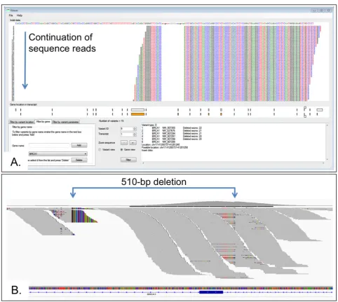 Figure 3.A: The AgilePindelFilter user interface. Reads are shown with respect to the reference sequence for a 510-bp BRCA1 exon 22 deletion.The identiﬁed variants can be restricted to speciﬁc genes and their location within the gene