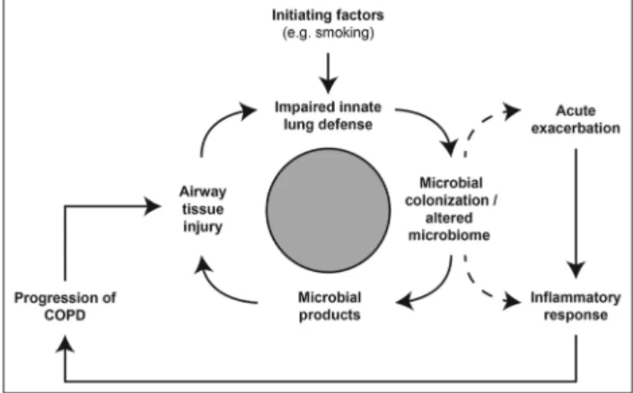 Figure 1: Vicious circle hypothesis of COPD. A model that explains 